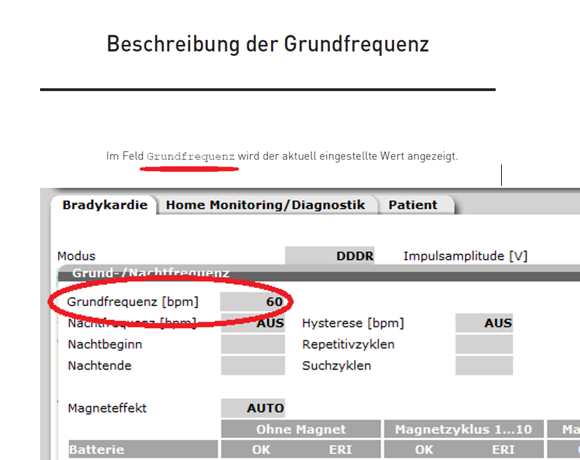 Consistency between documentation and software